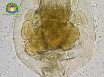 LUÂN TRÙNG ROTIFER